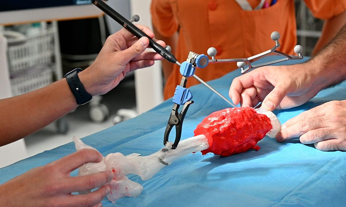 Hito en la sanidad pública madrileña: Salvan la pierna de un niño con tecnología 3D